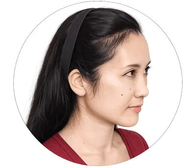 Keranique 4